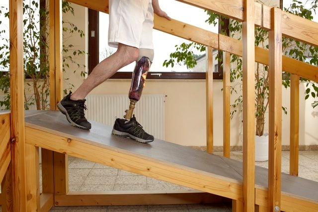 Financial Help for Amputees